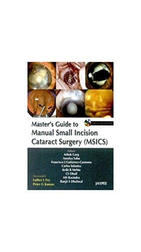 Master’s Guide to Manual Small Incision Cataract Surgery (MSICS)