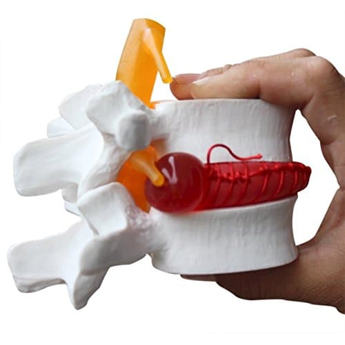 BoNew 1:1.5 Anatomical Human Lumbar Vertebrae Degenerative Lumbar Human Spine Model White Color