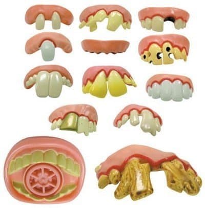 Billy Bob's Fun Fake Teeth, Set of 13 Rotten Denture Inserts