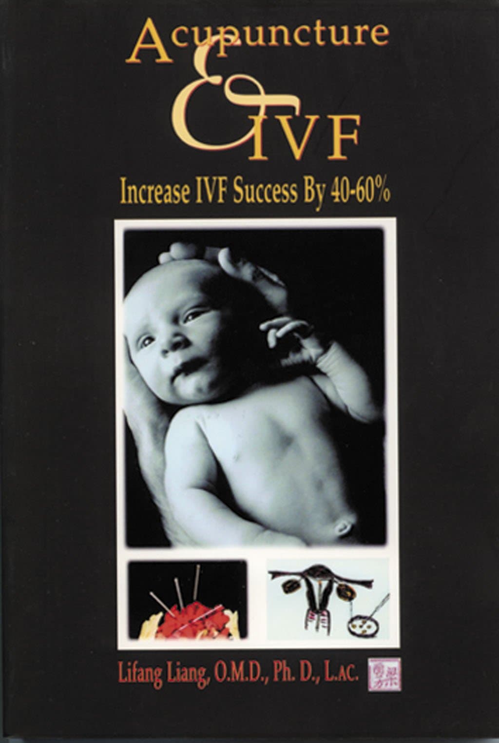 Acupuncture & IVF: Increase IVF Success by 40-60%