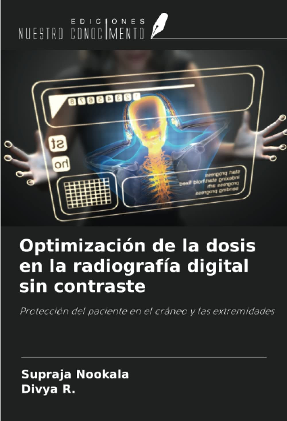 Optimización de la dosis en la radiografía digital sin contraste: Protección del paciente en el cráneo y las extremidades