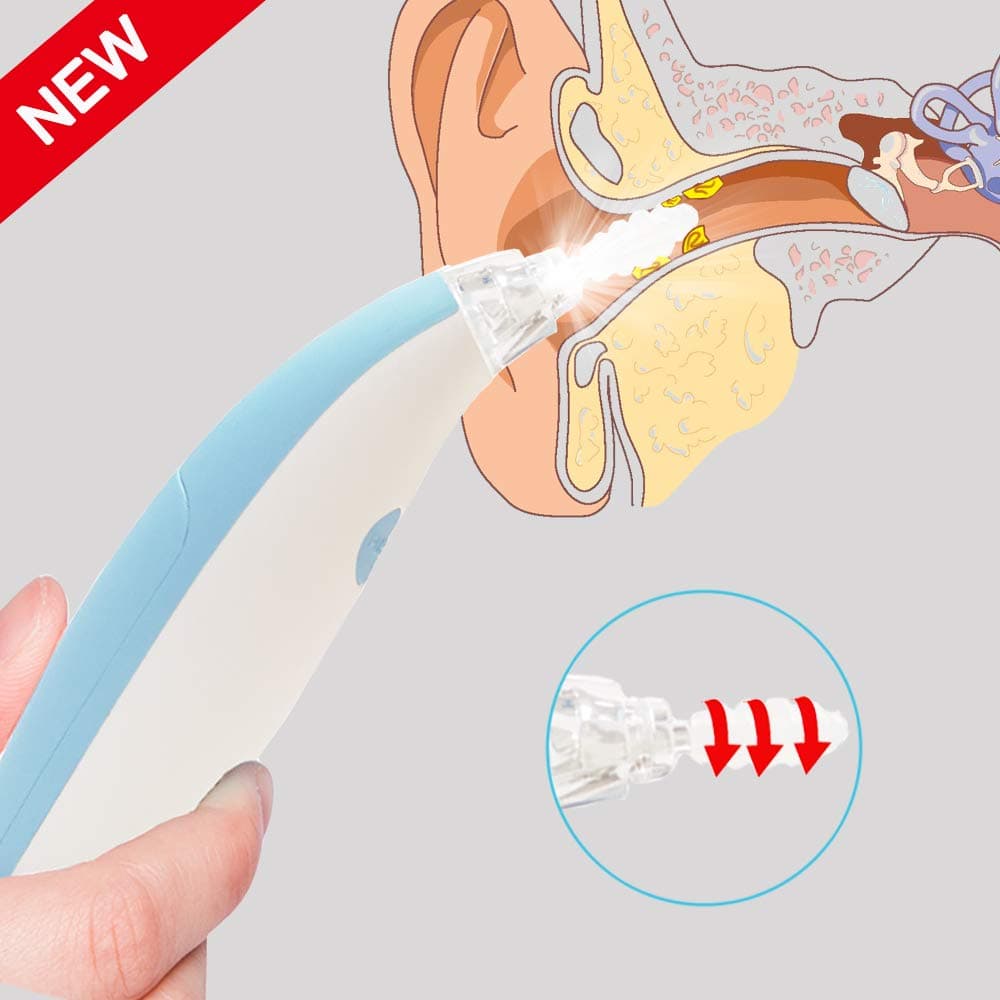 Ear Wax Removal Kit Tool, Spiral Ear Wax Cleaner Kit for Humans, Ear Syringes with 4 Silicone Spiral Tips, Safe and Comfortable Earwax Removal Tool with LED Lights for People of All Ages (Blue)