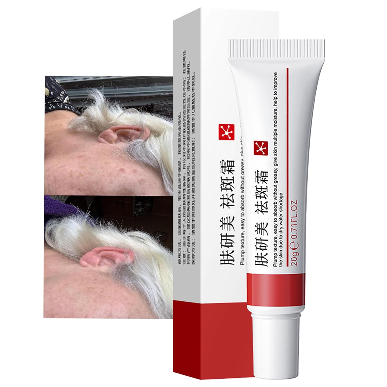 Generic Crema para Manchas Oscuras en La Cara, Dark Spot Remover for Face, Freckles Melasma Brown Spot Corrector for Men Women, Crema para Las Manchas de La Cara 20G