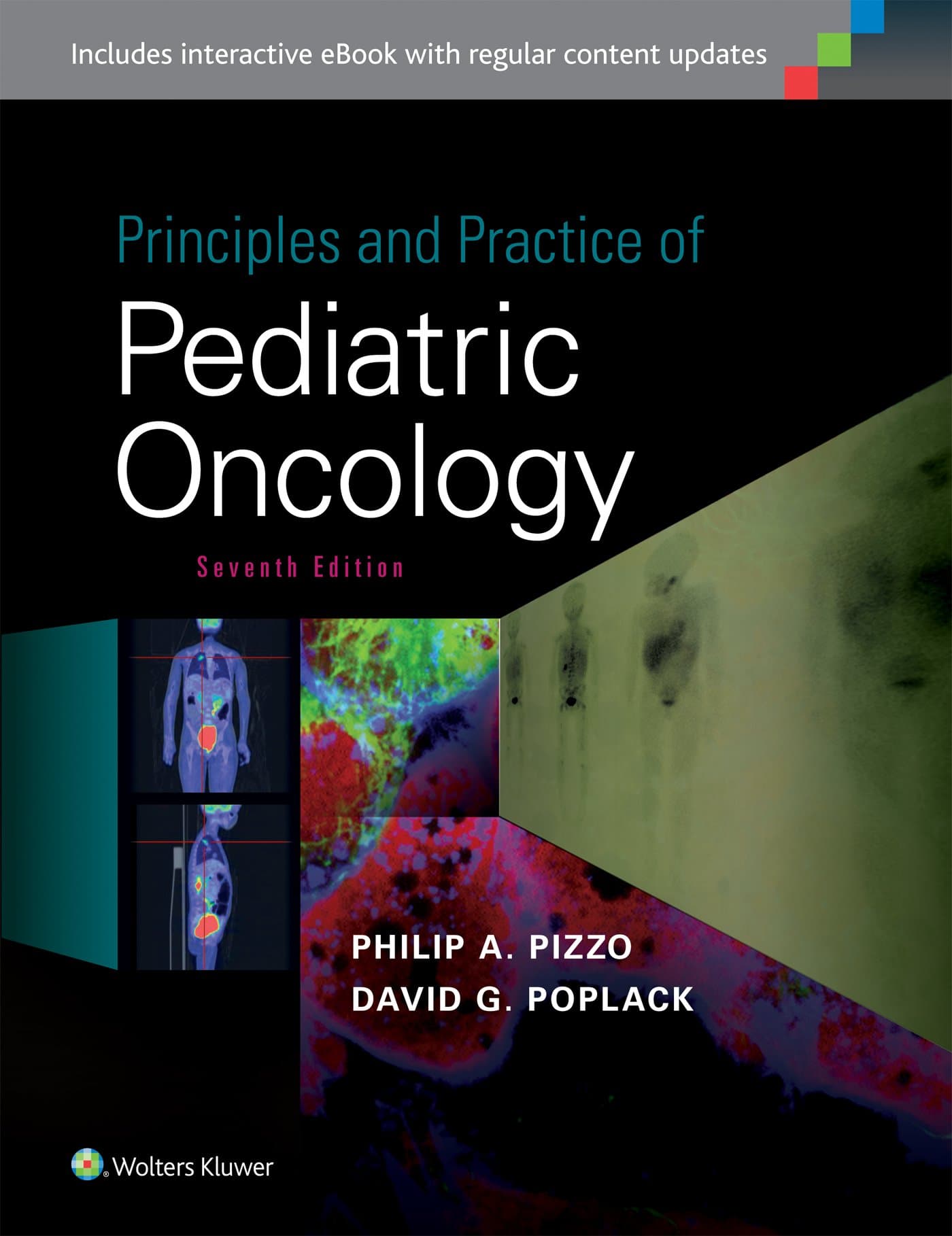 Principles and Practice of Pediatric Oncology Hardcover – 25 Aug. 2015