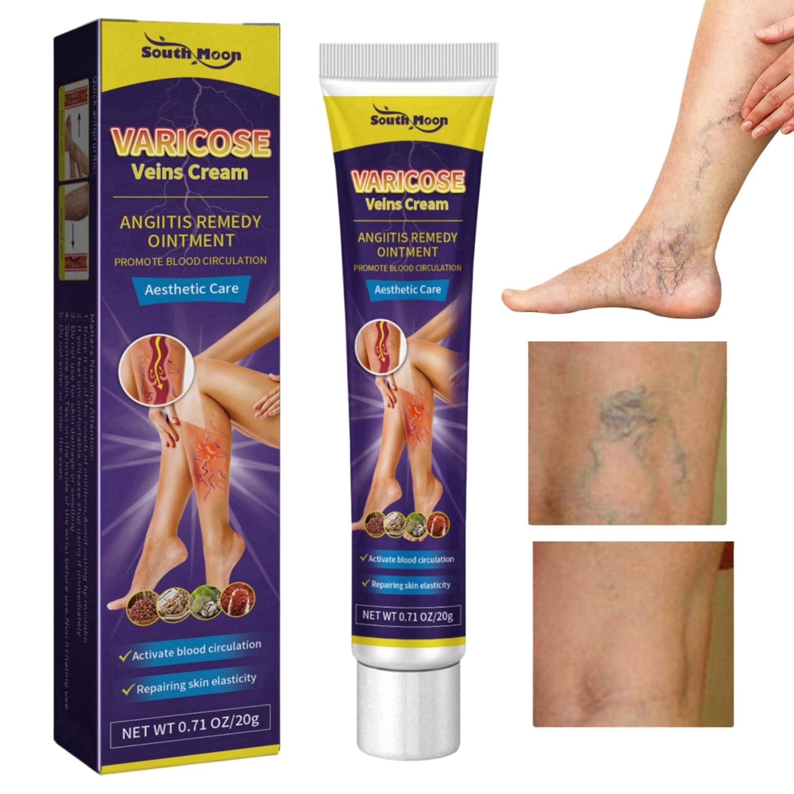 Varicose Veins Cream,Spider Vein Cream,Varicose Veins Relief Cream,Spider Veins Repair Cream,Varicose Veins Treatment for Legs,Vein Cream for Legs Aching Legs Relief,Cream for Varicose Veins in Legs