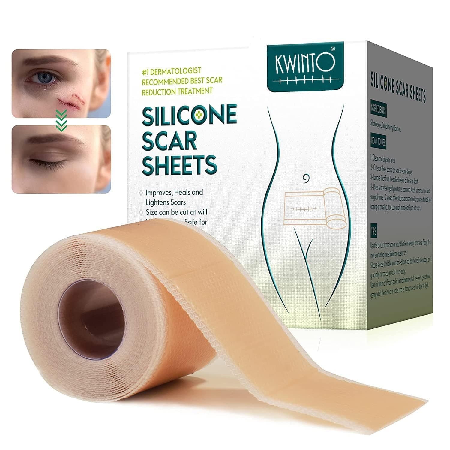 Silicone Scar Sheets, Silicon gel sheets for Scars Transparent Medical Silicone Gel Tape for Scar Removal, Silicone Scar Tape Roll For Hypertrophic Scars and Keloids Caused by Surgery