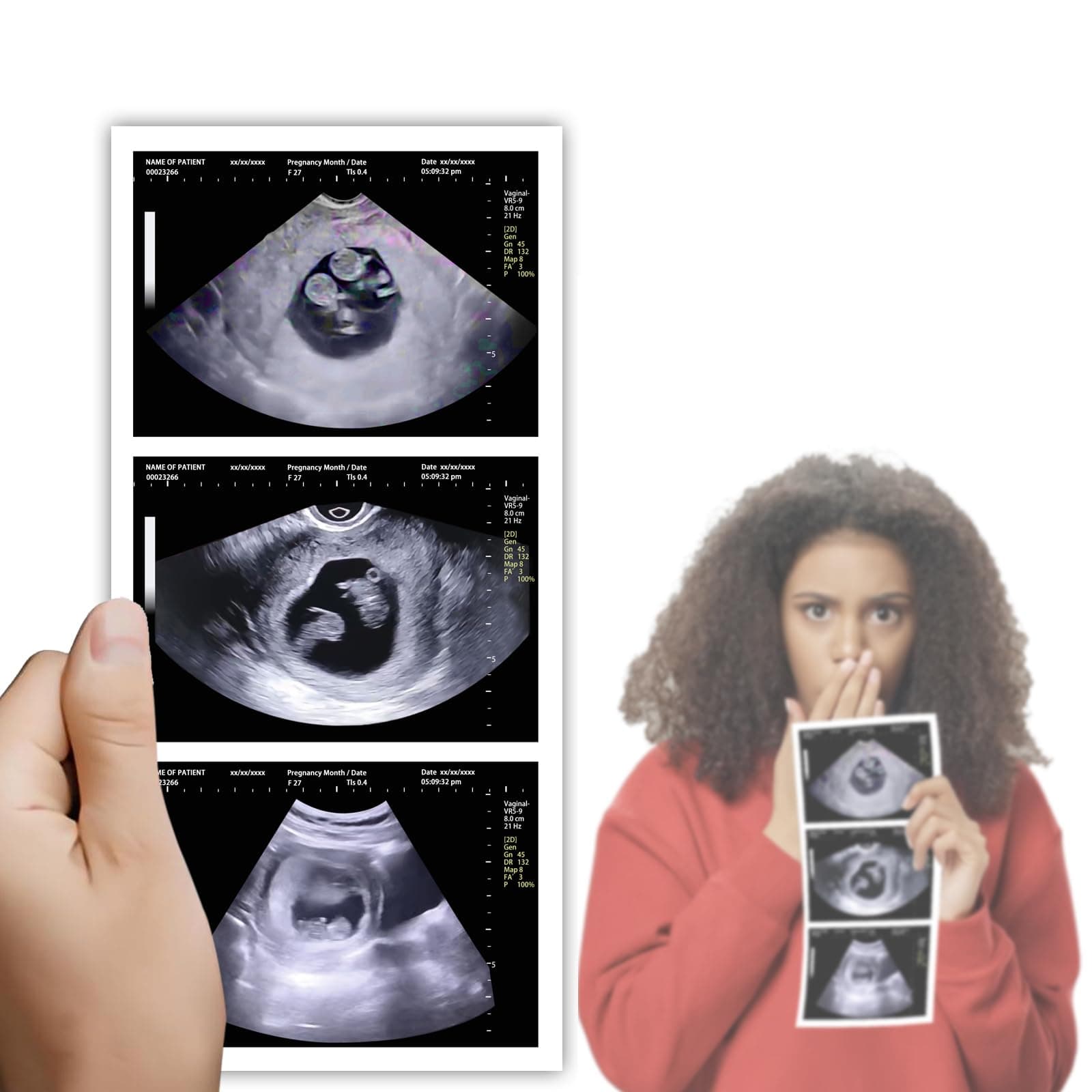 Personalized Fake Prank Ultrasound with 3 Photos Customized Prank Pregnant Sonogram Gag Gift for Family and Boyfriend (Twins 10 Weeks)