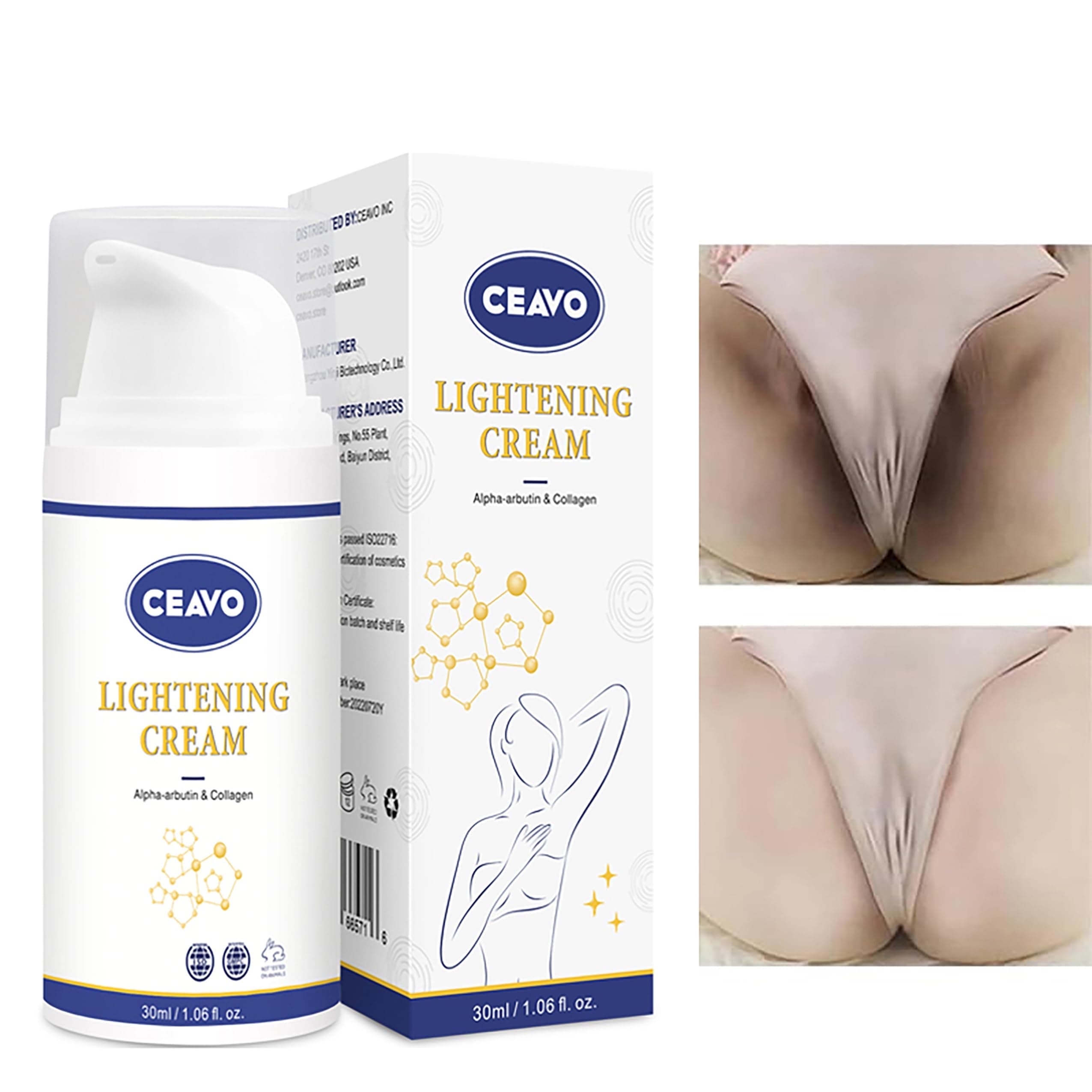 Skin Lightening Cream for Dark Areas - Underarm, Knees, Elbows, Bikini Line - Permanent Whitening & Dark Spot Remover, 1 oz, USA Designed