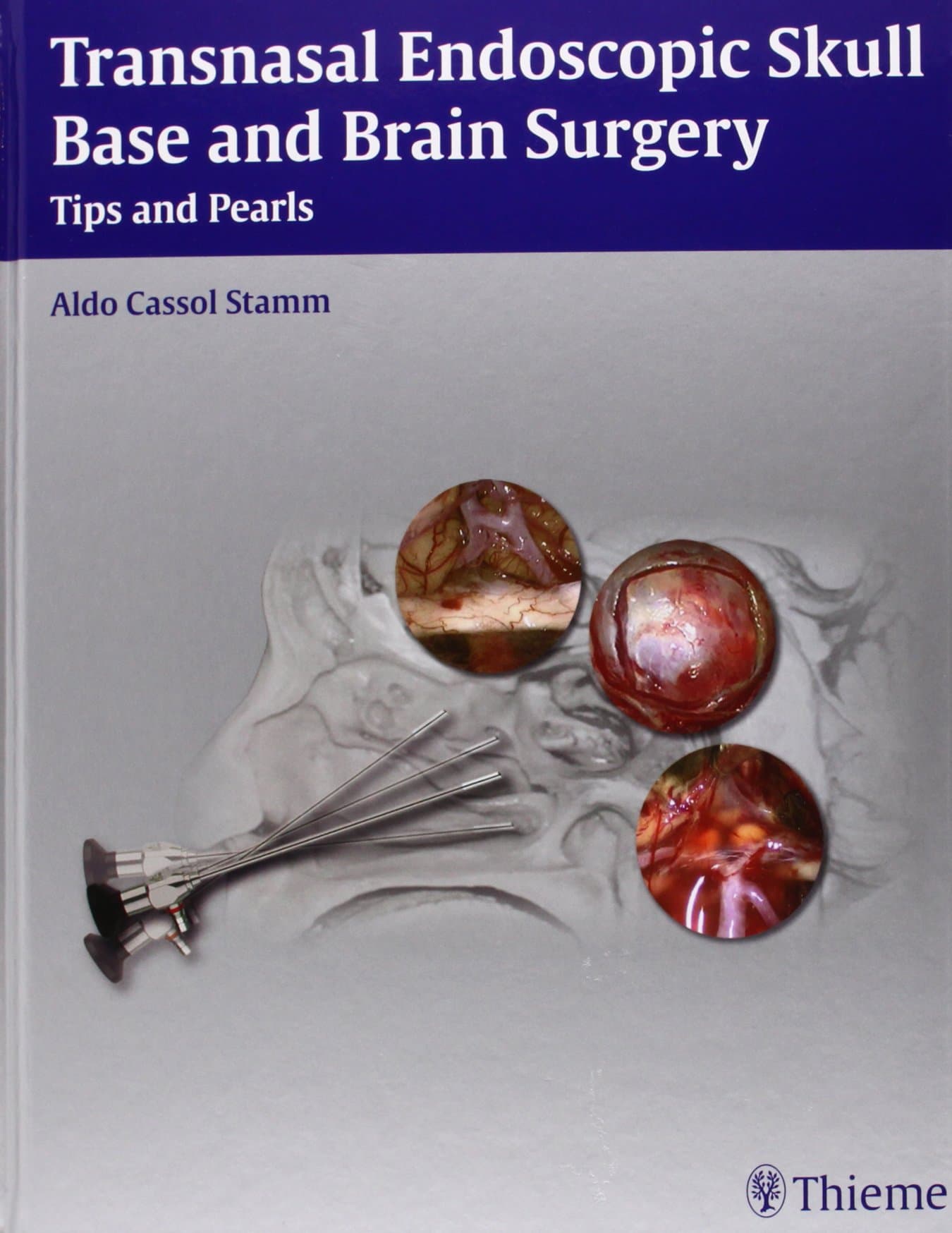 Transnasal Endoscopic Skull Base and Brain Surgery: Tips and Pearls 1st Edition
