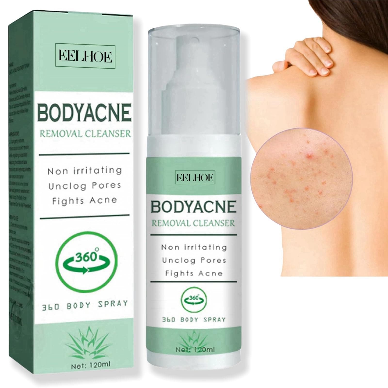 Back Acne Treatment Spray - Body Acne Moisturizer for Smooth Skin - Skin Care Spray for Back and Body